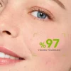 مراقبت ست پوست آکنه نقاط ضد مشکی برند Bioderma کد 1753633390